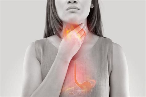 Heartburn Overview Symptoms Diagnoses Causes And 20 Home Remedies