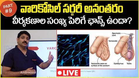 Can Sperm Count Increase After Varicocele Surgery Dr Rahul Reddy Androcare Andrology