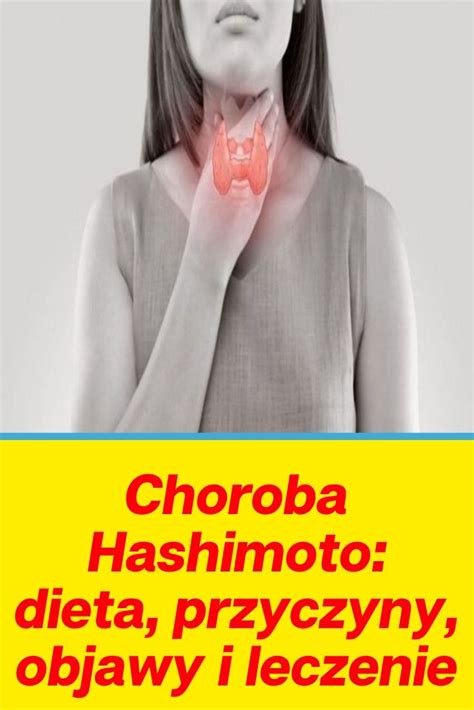 Choroba Hashimoto Objawy Przyczyny Leczenie Profilaktyka My Xxx Hot