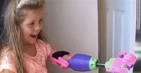 Watch This Girl Open Her 3d Printed Arm And Get The World In Her Grasp