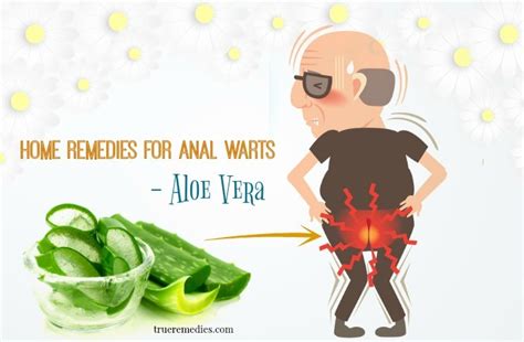 Top 22 Natural And Effective Home Remedies For Anal Warts