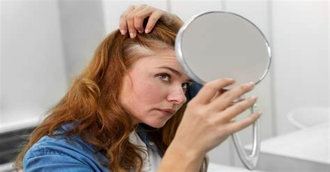 How To Get Rid Of Oily Scalp Causes And Home Remedies For Oily Scalp