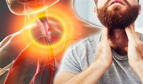 Oesophageal Cancer A Feeling Like Something Is Stuck In Your Throat Is