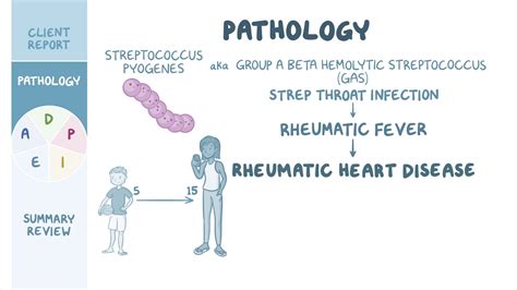 Rheumatic Heart Disease Nursing Process Adpie Osmosis Video Library