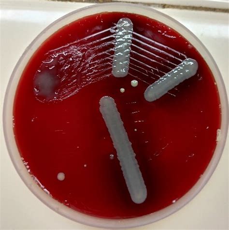 Blood Agar Plate Showing Growth After 48 Hours Of Incubation Download