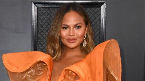 Chrissy Teigen Reveals She Had Plastic Surgery Early In Her Career