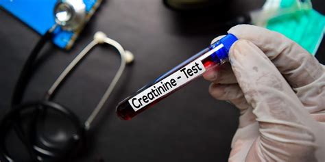 Urine tests are among the most common types of drug testing used by companies in the u.s., even though numerous studies show they don't improve what chemicals are used to subvert urine drug testing? Creatinine Clearance Test, Pemeriksaan untuk Melihat ...