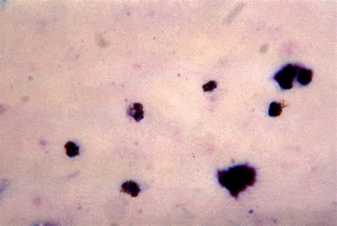 Free Picture Micrograph Five Old Growing Plasmodium Malariae