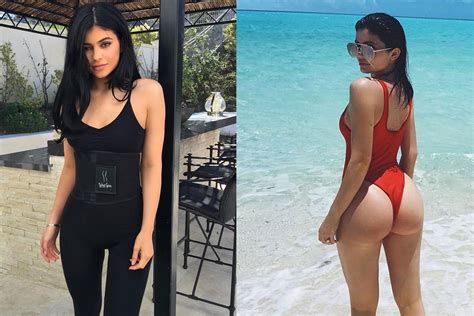 Kylie Jenner Plastic Surgery Before And After Who Magazine