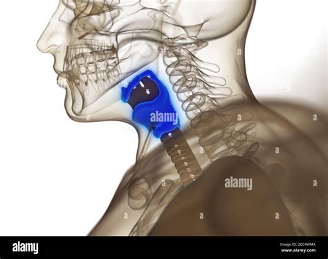 Menschlicher Larynx Tumor Fotos Und Bildmaterial In Hoher Aufl Sung
