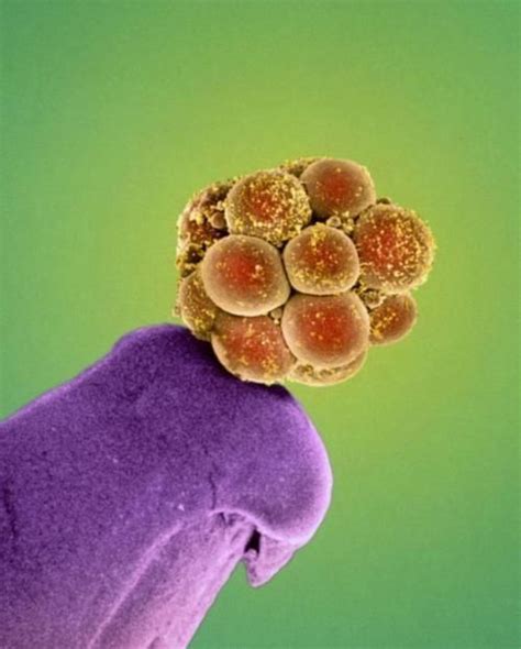 Pin By Stephen Laureti On Sponge Cake Human Embryo Microscopic