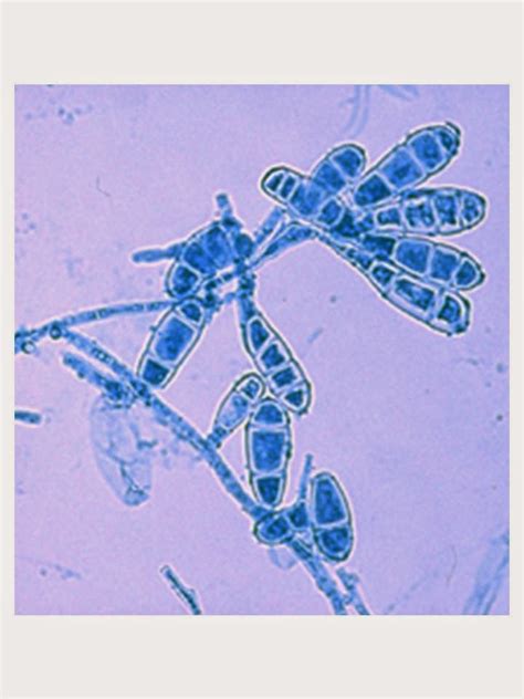 Micelio Epidermophyton Floccosum