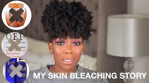 How I Stopped Bleaching My Skin Bleaching Story Inspired By Jackie