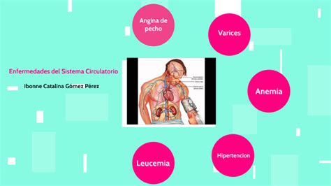 Enfermedades del Sistema Circulatorio Humano by Catalina Gómez on Prezi