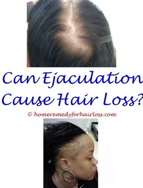 Celiac Disease Hair Thinning No Pattern Hair Loss Hair Transplant