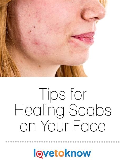 Healing Scabs On Your Face Lovetoknow Health And Wellness Scab