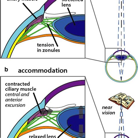 The Action Of Ciliary Muscle Contraction On Accommodation Of The Lens