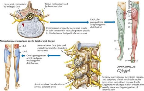 L5 Nerve Root Anatomy