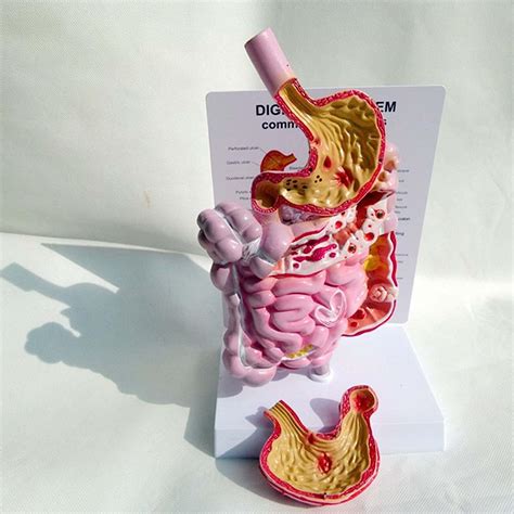İnsan Anatomik Anatomi Sindirim Sistemi Modeli Yaşam babeu Anatomik Yapı Rektum Duodenum İç