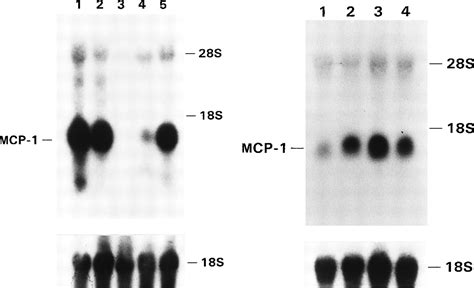 Induction Of Monocyte Chemoattractant Protein 1 Synthesis In Human Monocytes During