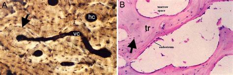 2 Histological Structure Of Bone Tissue A Cortical Bone Haversian