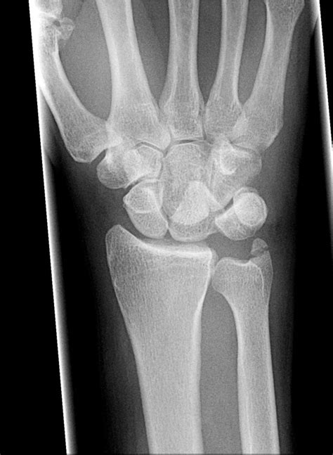 Not Your Typical Wrist Pain — EM Curious
