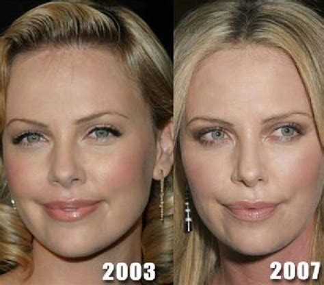 Charlize Theron Before And After Plastic Surgery Celebrity