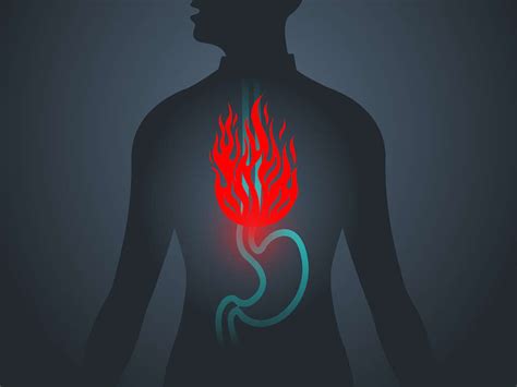 Heartburn 10 Foods That Cause Heartburn
