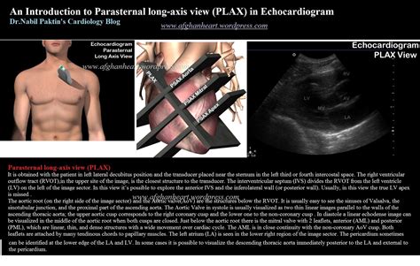 Drnabil Paktins Cardiology Blog مجله کاردیولوژی دکتور نبــیل پاکطـین