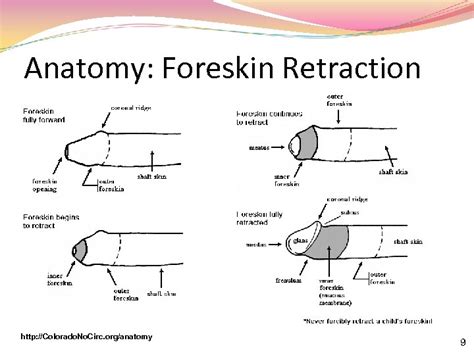 Circumcision And The Foreskin Presented By Craig Garrett