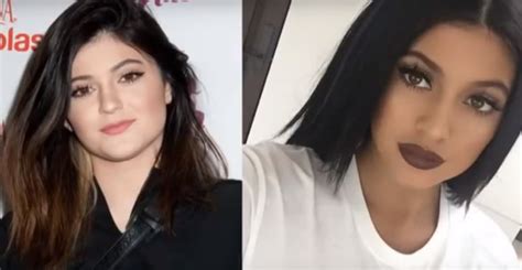 Before the procedure her lips were thin and that did not make her face look good. Kylie Jenner Plastic Surgery Transformations - Top Piercings
