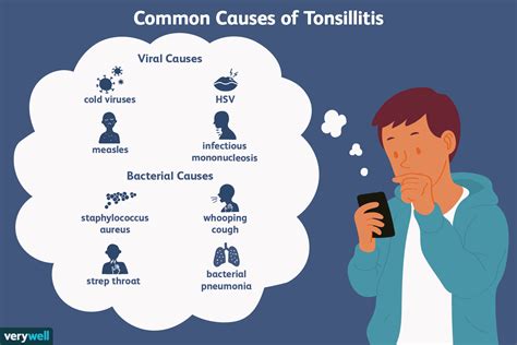 Tonsillitis Causes Diagnosis And Treatment