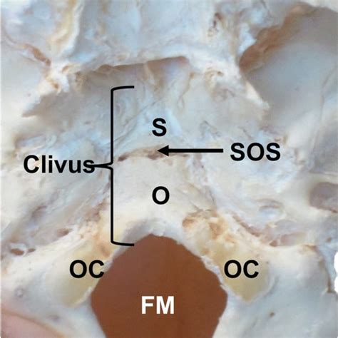 Blood Supply To The Clivus Derived From The Meninohypophyseal Trunk