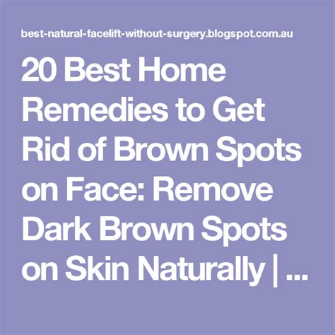 20 Best Home Remedies To Get Rid Of Brown Spots On Face Remove Dark