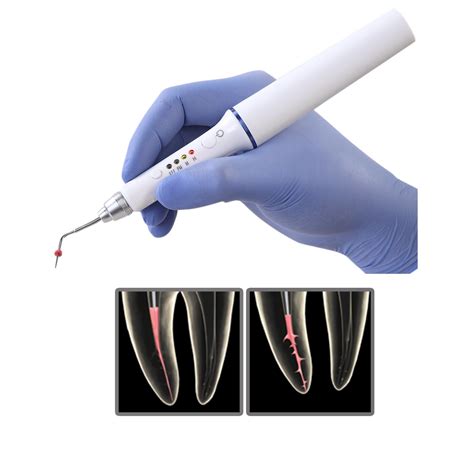 dental equipment medical device j1ss obturation pen endodontic instrument heating system