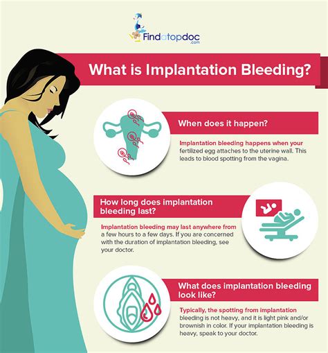 What Is Implantation Bleeding Photograph By Finda Topdoc