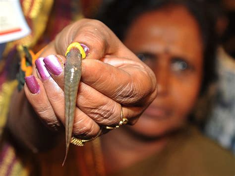 Indian Believers Swallow Live Fish As Asthma Cure