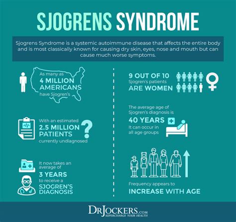 Sjogren S Syndrome Causes Risk Factors Signs Symptoms