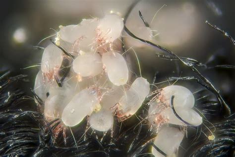 House Dust Mites House Dust Mites Dermatophagoides Pteron Flickr