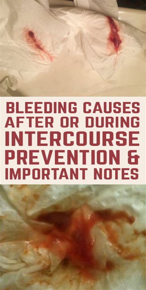 What Causes Bleeding After Sexual Intercourse