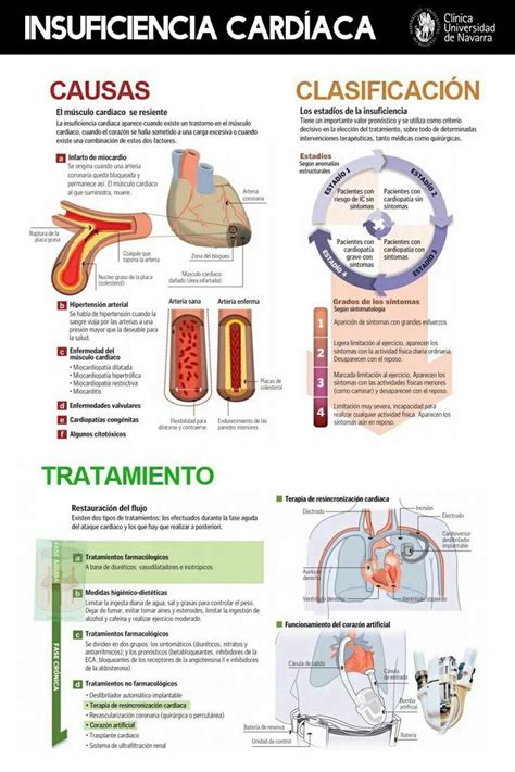 Insuficiencia Cardíaca Infografias Infographic Auxiliar De