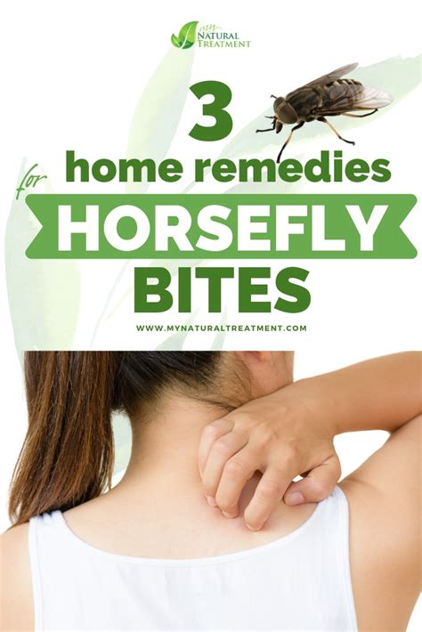 3 Quick Home Remedies For Horsefly Bites Horsefly Sting