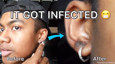 My New Piercings Got Infected🤢 Warning Gross Youtube