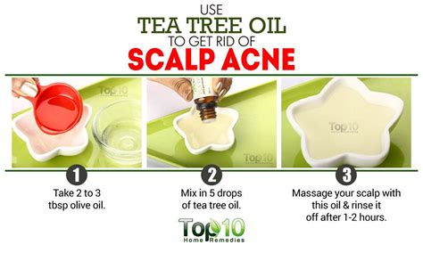 How To Get Rid Of Scalp Acne Top 10 Home Remedies