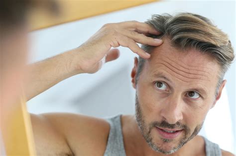 Hair Loss Doctors Dermatology