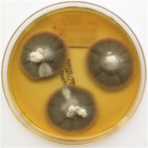 Aureobasidium Melanogenum On Ygc Top And Malt Extract Bottom Agar