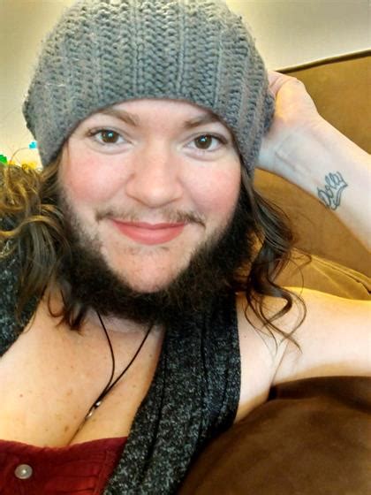 Bearded Woman Who Started Growing Facial Hair At 12 Feels More Confident With Full Beard