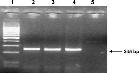 Pcr Detection Of Mycobacterium Tuberculosis Complex Lane 1 Molecular