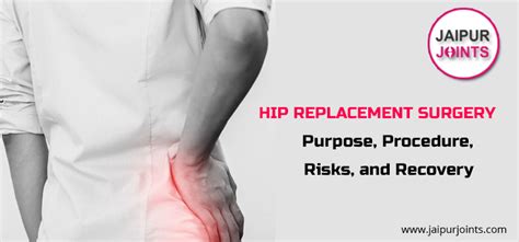 Hip Joint Replacement Surgery Risks Purpose And Recovery By Dr Modi