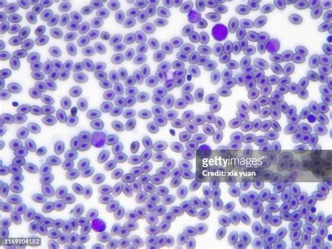 Blood Cell Texture Photos And Premium High Res Pictures Getty Images